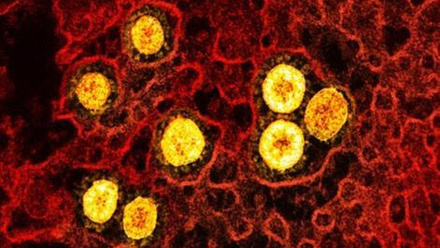 6873_novel_coronavirus_sarscov2_omicron_52241171666_49633_crop (1).jpg